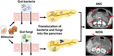 Role of leucine-rich repeat kinase 2 in severe acute pancreatitis